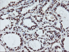 NONO Antibody in Immunohistochemistry (Paraffin) (IHC (P))