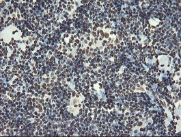 NONO Antibody in Immunohistochemistry (Paraffin) (IHC (P))