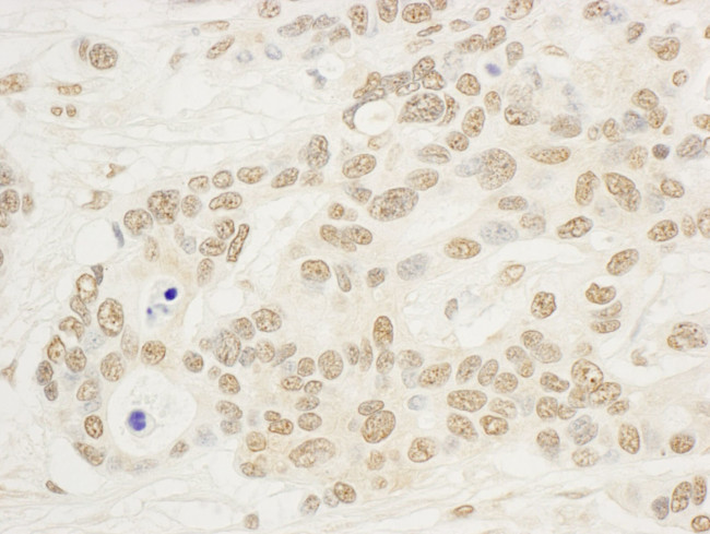 NOP132 Antibody in Immunohistochemistry (IHC)