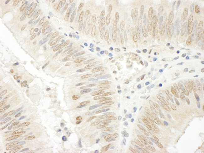 NOPP140 Antibody in Immunohistochemistry (IHC)