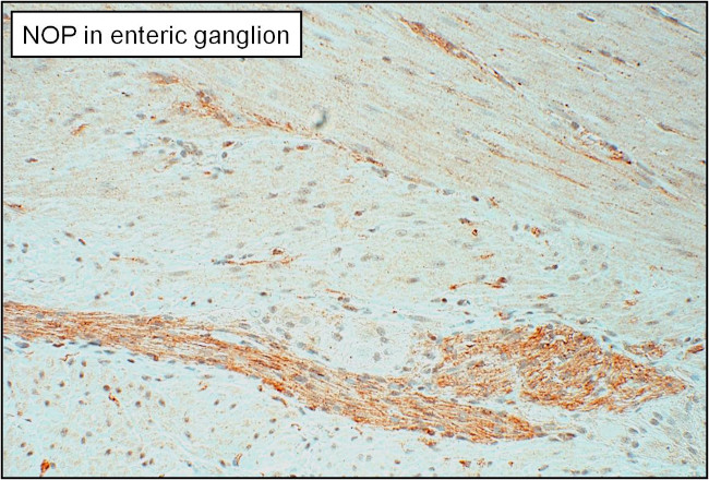 OPRL1 Antibody in Immunohistochemistry (Paraffin) (IHC (P))