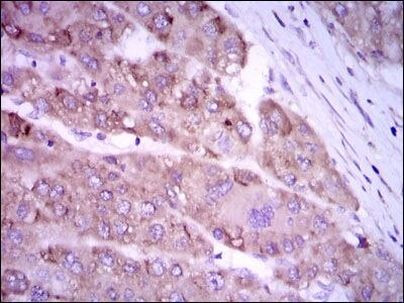 iNOS Antibody in Immunohistochemistry (Paraffin) (IHC (P))