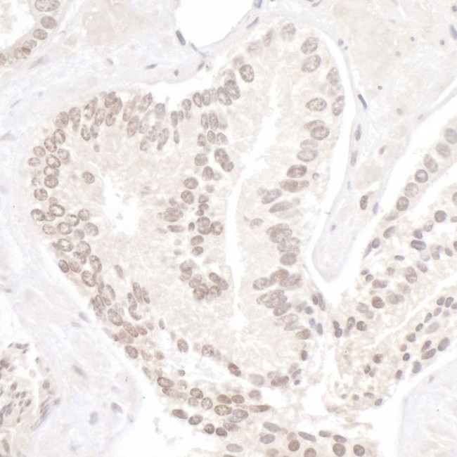 NP95/UHRF1 Antibody in Immunohistochemistry (IHC)