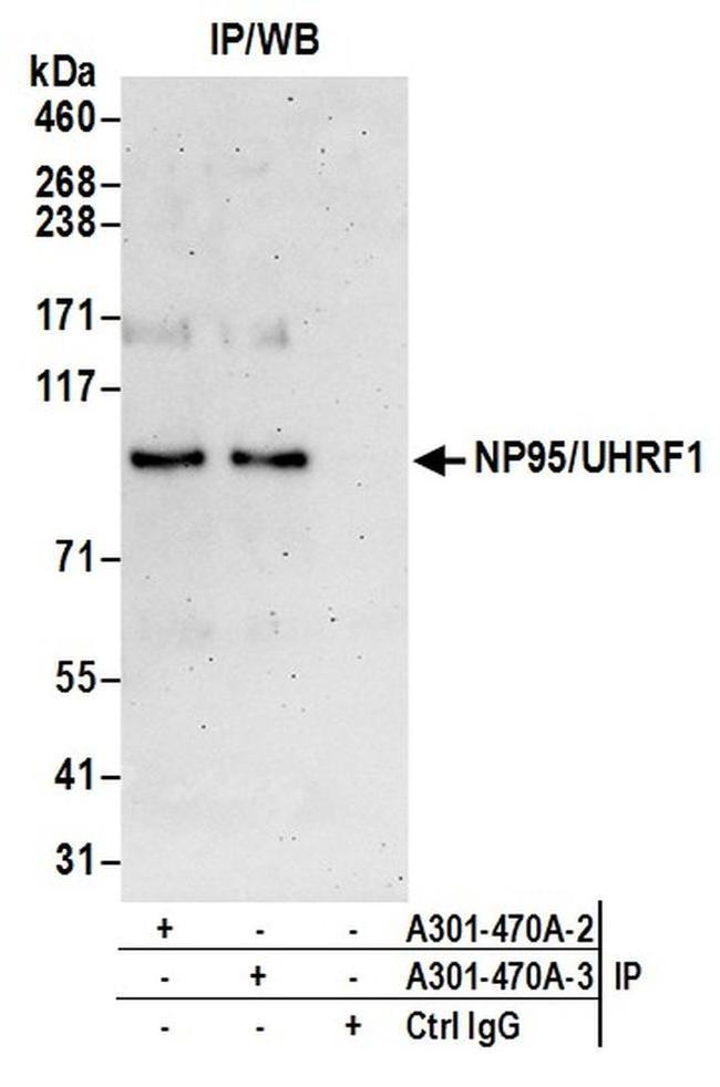 NP95/UHRF1 Antibody in Western Blot (WB)