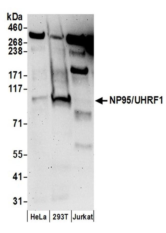 NP95/UHRF1 Antibody in Western Blot (WB)