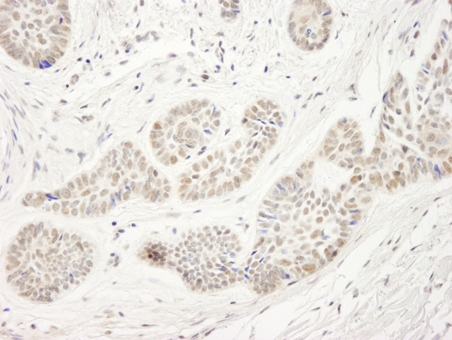 NP95/UHRF1 Antibody in Immunohistochemistry (IHC)