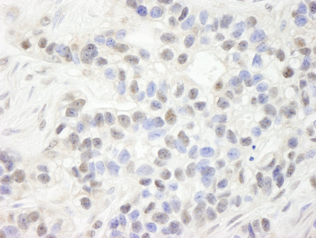 NP95/UHRF1 Antibody in Immunohistochemistry (IHC)