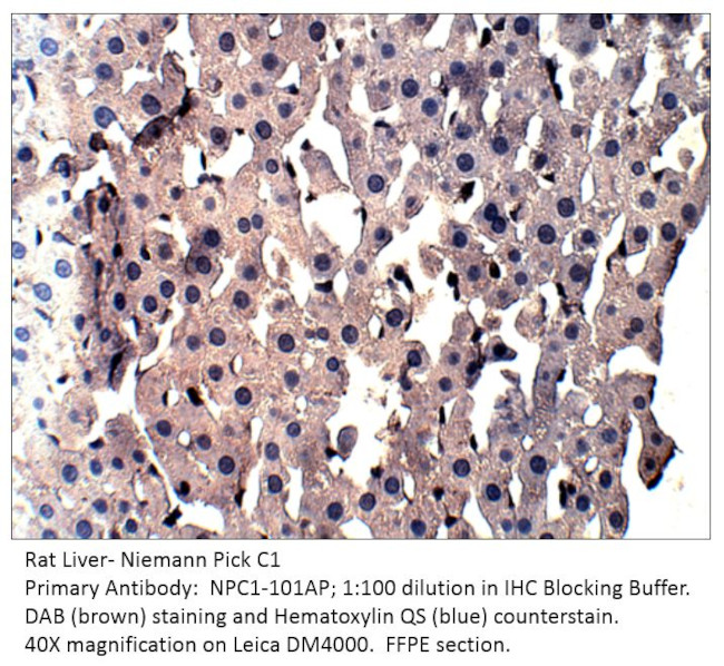 Niemann Pick C1 Antibody in Immunohistochemistry (IHC)