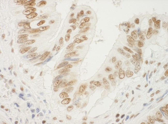 NPM1 Antibody in Immunohistochemistry (IHC)