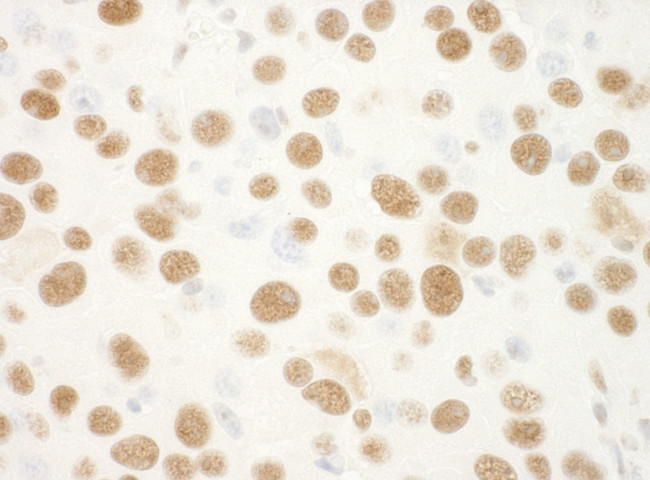 NPM1 Antibody in Immunohistochemistry (IHC)