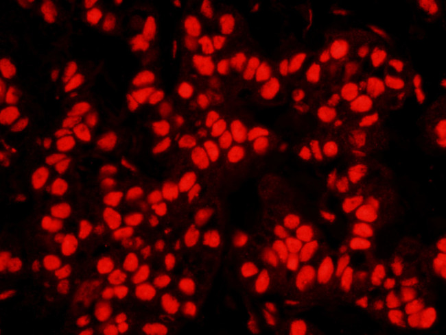 NPM1 Antibody in Immunohistochemistry (IHC)