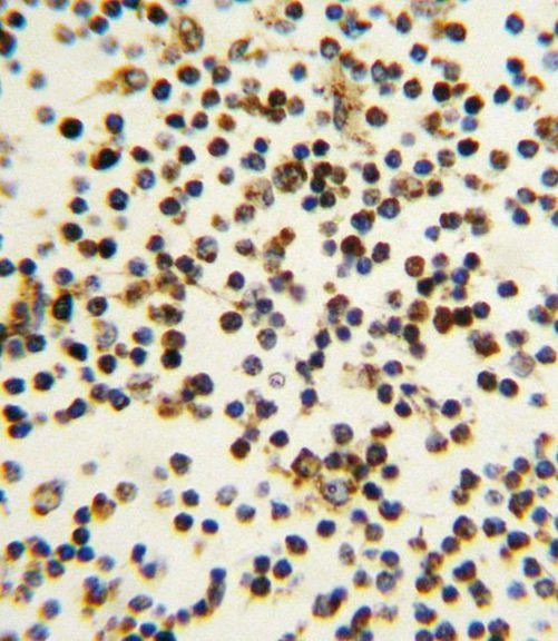 NPM1 Antibody in Immunohistochemistry (IHC)