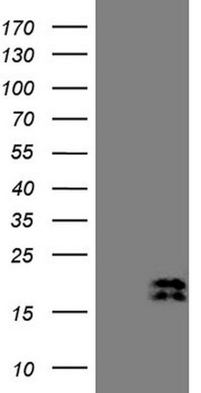 NPPB Antibody in Western Blot (WB)