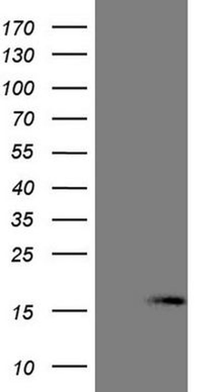 NPPB Antibody in Western Blot (WB)