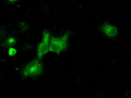 NPR3 Antibody in Immunocytochemistry (ICC/IF)