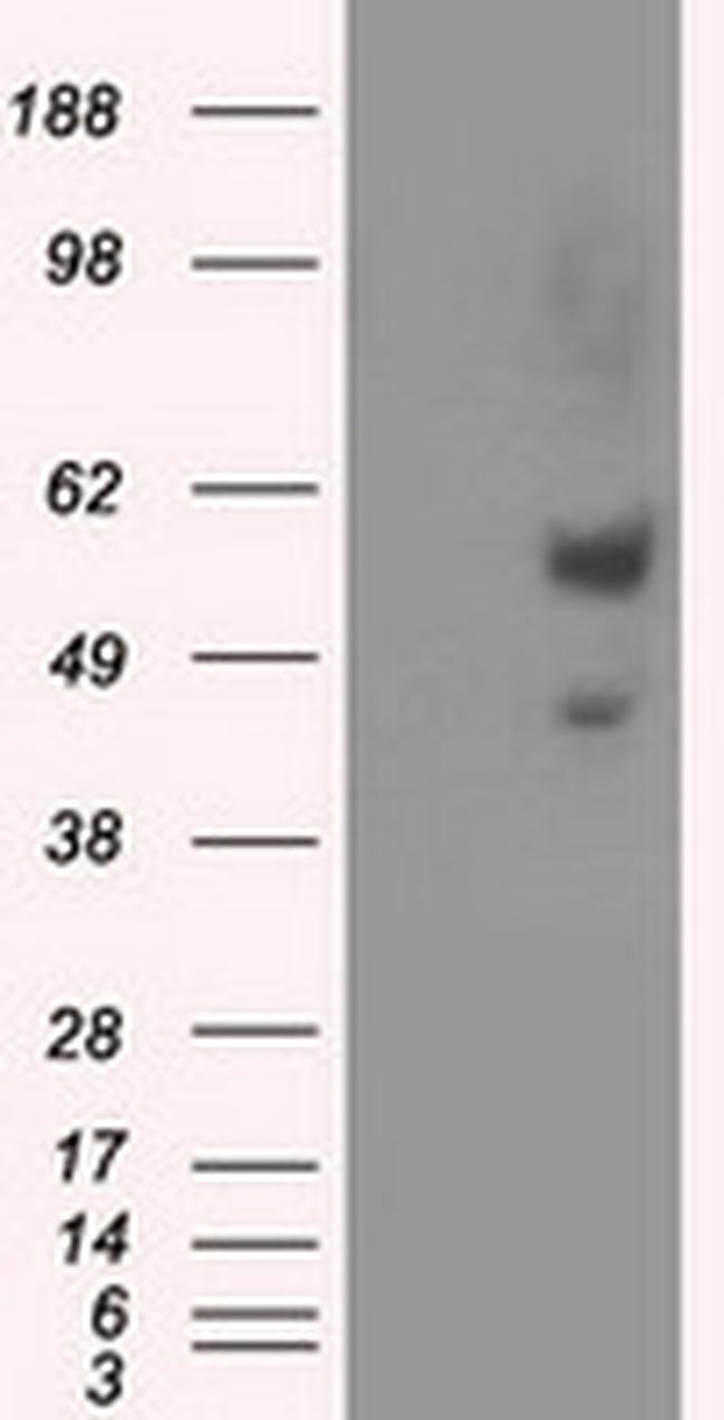 NPR3 Antibody in Western Blot (WB)