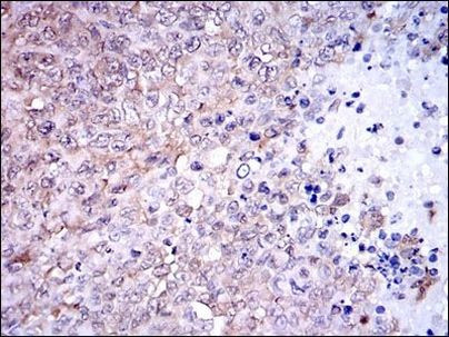 NQO1 Antibody in Immunohistochemistry (Paraffin) (IHC (P))