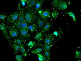 NQO2 Antibody in Immunocytochemistry (ICC/IF)