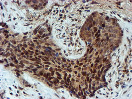 NQO2 Antibody in Immunohistochemistry (Paraffin) (IHC (P))