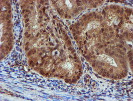 NQO2 Antibody in Immunohistochemistry (Paraffin) (IHC (P))