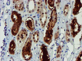 NQO2 Antibody in Immunohistochemistry (Paraffin) (IHC (P))