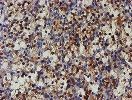 NQO2 Antibody in Immunohistochemistry (Paraffin) (IHC (P))