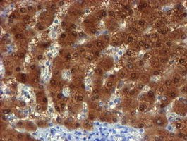 NQO2 Antibody in Immunohistochemistry (Paraffin) (IHC (P))