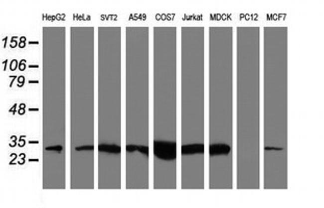 NQO2 Antibody in Western Blot (WB)