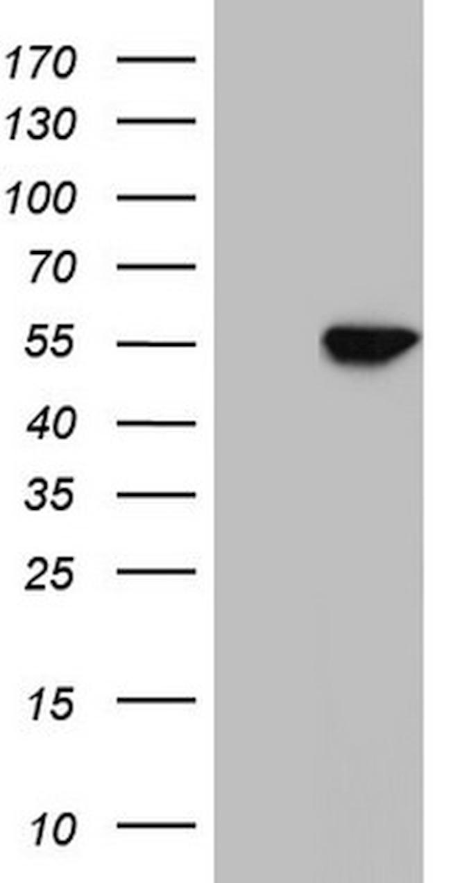 NR1H3 Antibody in Western Blot (WB)