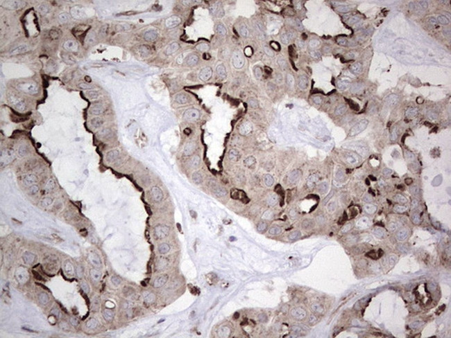 NR1I3 Antibody in Immunohistochemistry (Paraffin) (IHC (P))