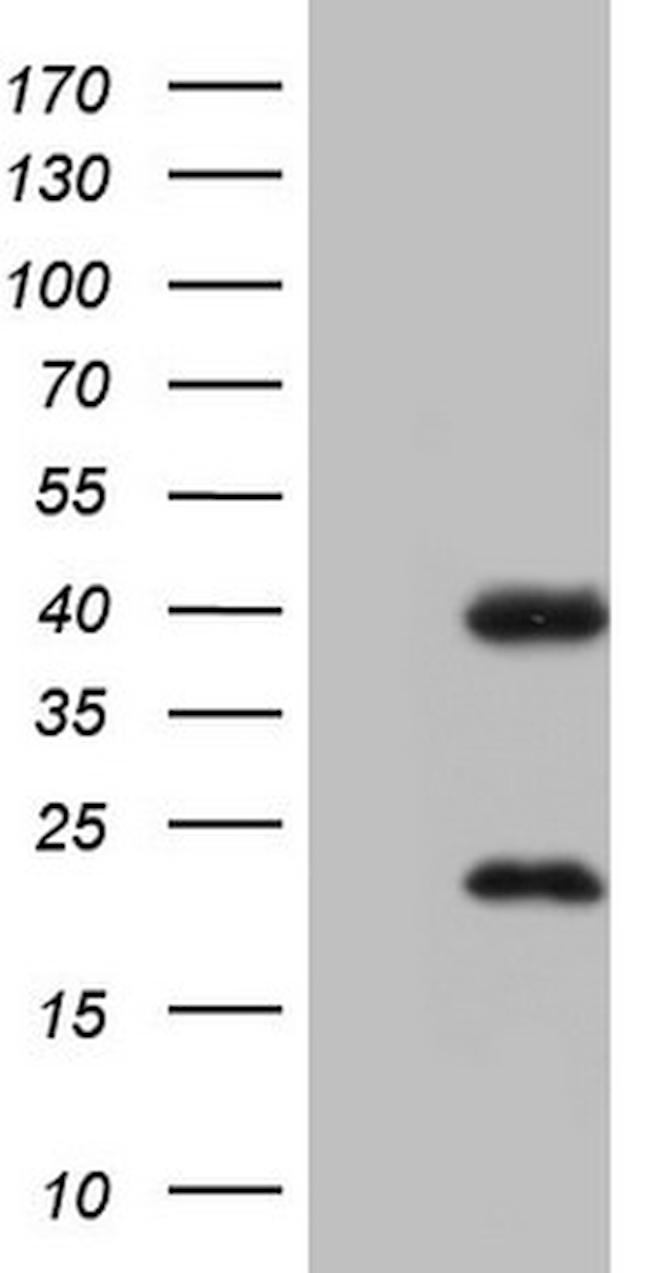 NR1I3 Antibody in Western Blot (WB)