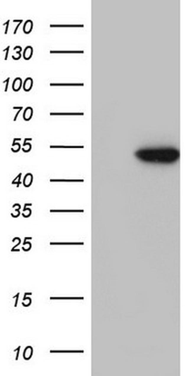 NR2C1 Antibody in Western Blot (WB)