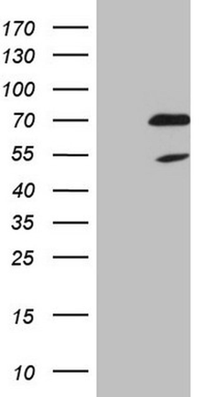 NR2C2 Antibody in Western Blot (WB)