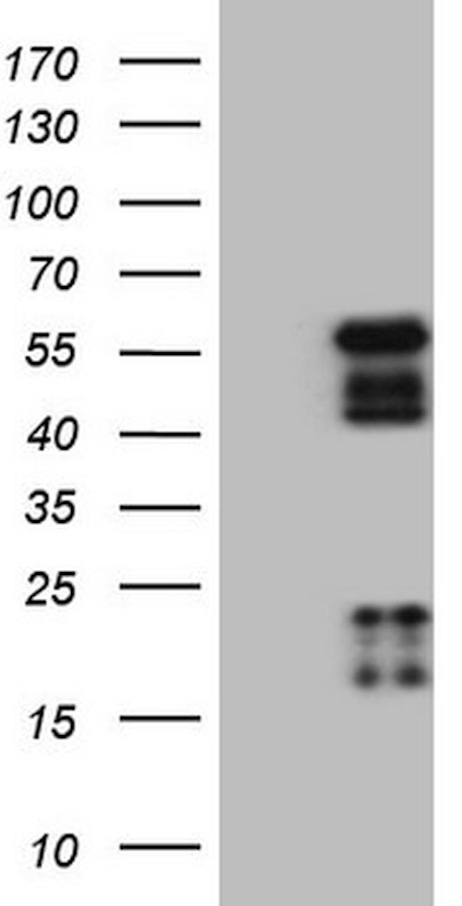 NR2E3 Antibody in Western Blot (WB)