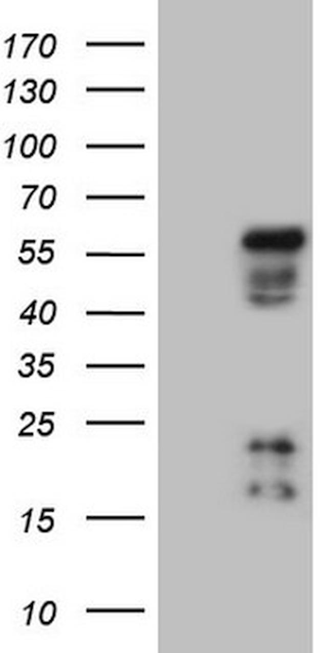 NR2E3 Antibody in Western Blot (WB)