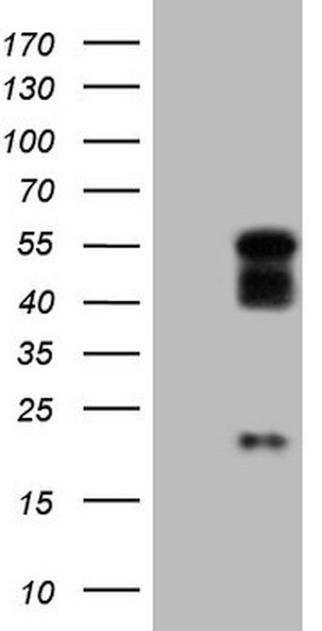 NR2E3 Antibody in Western Blot (WB)