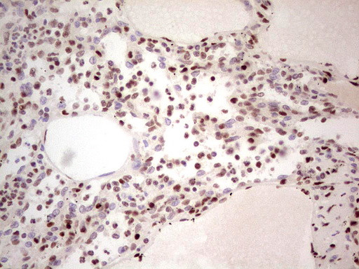 NR3C1 Antibody in Immunohistochemistry (Paraffin) (IHC (P))