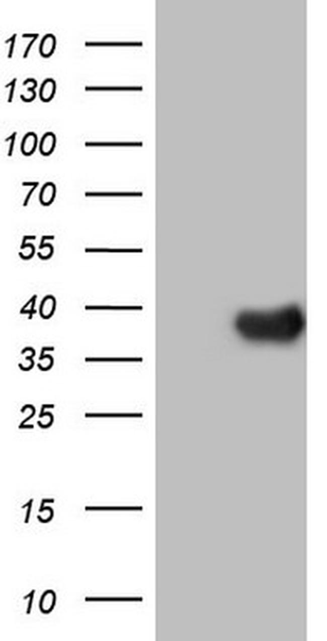 NR5A2 Antibody in Western Blot (WB)