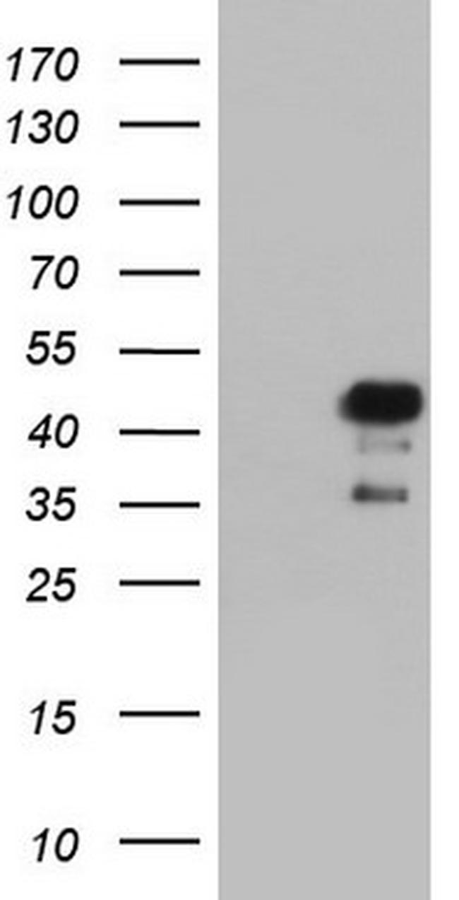 NRBF2 Antibody in Western Blot (WB)