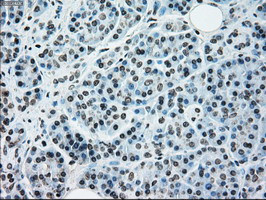 NRBP1 Antibody in Immunohistochemistry (Paraffin) (IHC (P))