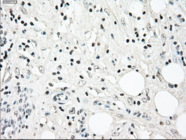 NRBP1 Antibody in Immunohistochemistry (Paraffin) (IHC (P))