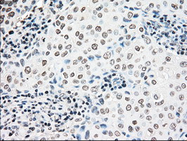 NRBP1 Antibody in Immunohistochemistry (Paraffin) (IHC (P))