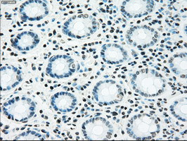 NRBP1 Antibody in Immunohistochemistry (Paraffin) (IHC (P))