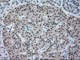 NRBP1 Antibody in Immunohistochemistry (Paraffin) (IHC (P))