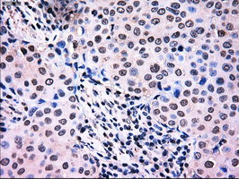 NRBP1 Antibody in Immunohistochemistry (Paraffin) (IHC (P))