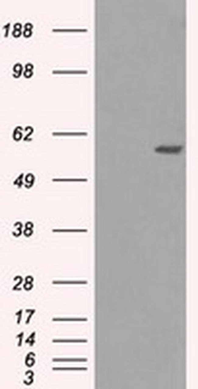 NRBP1 Antibody in Western Blot (WB)