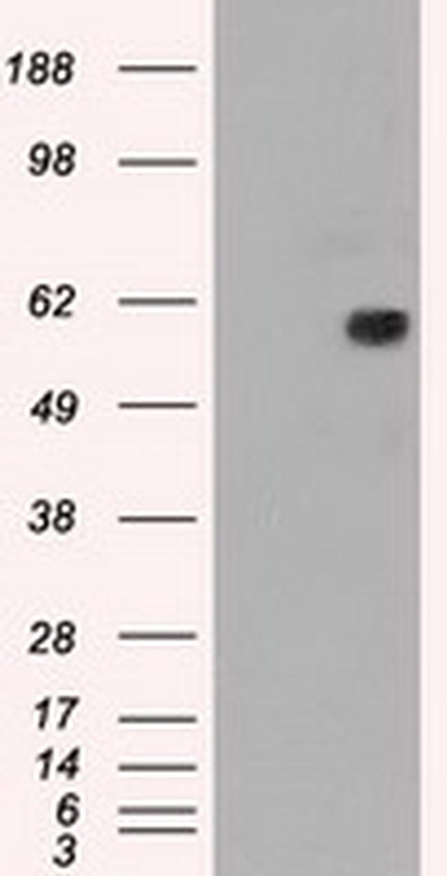 NRBP1 Antibody in Western Blot (WB)