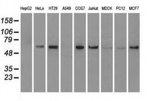 NRBP1 Antibody in Western Blot (WB)