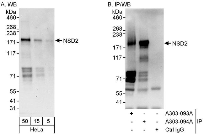 NSD2 Antibody in Western Blot (WB)
