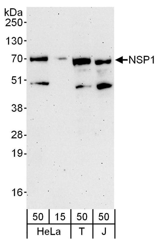 NSP1 Antibody in Western Blot (WB)